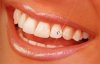 dentista economico